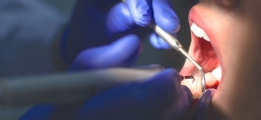 Dentysta jest w stanie dostrzec raka. Dr Agnieszka Laskus o znaczeniu profilaktyki stomatologicznej