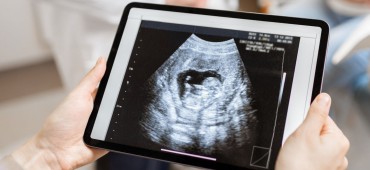 Wytyczne dla lekarzy w sprawie przerywania ciąży. Co zmieniły w praktyce?